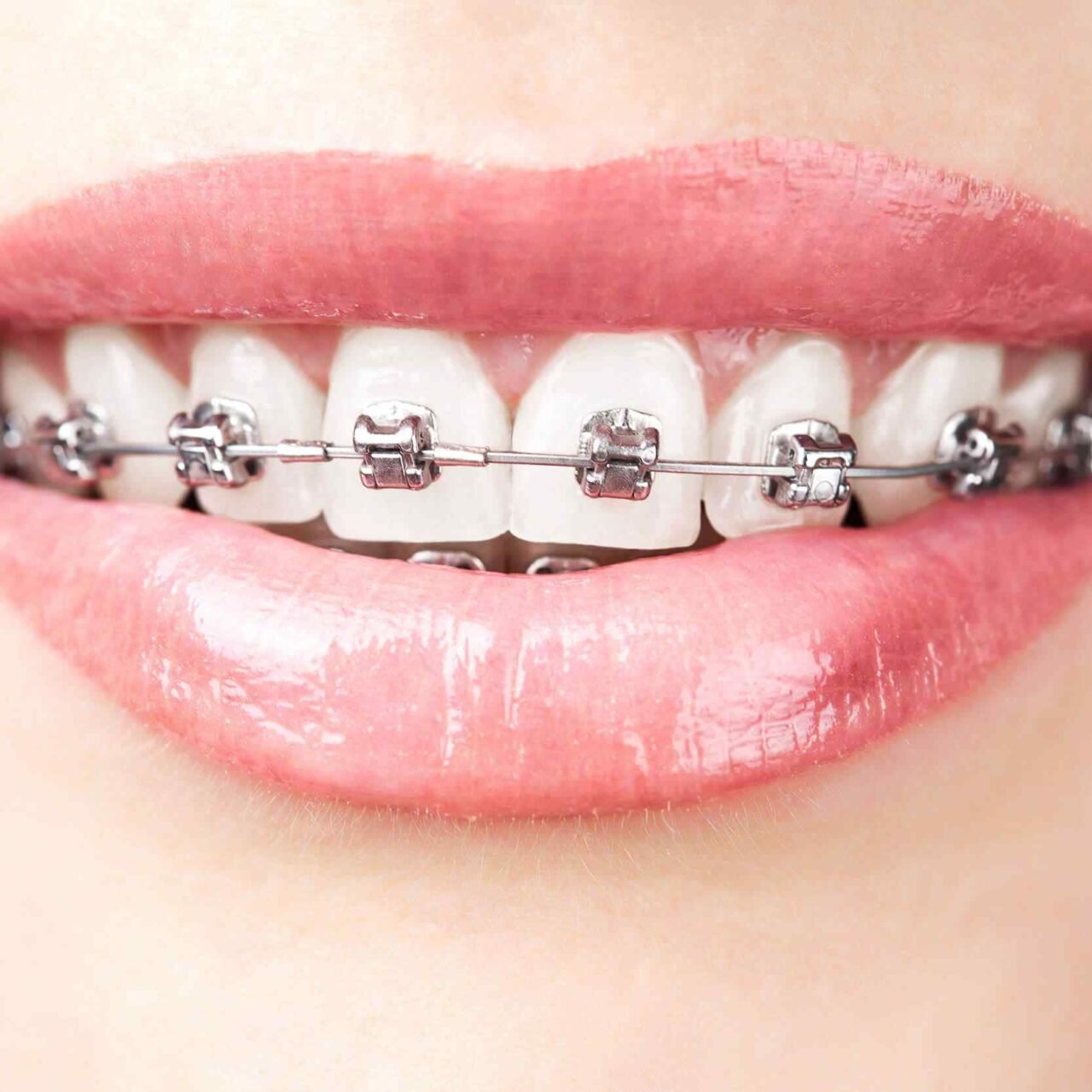 https://aljomanclinics.com/wp-content/uploads/2020/01/post-03-1280x1280.jpg